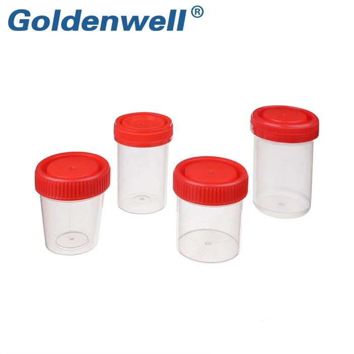 Disposable Medical Vacuum Urine Collection Tube with Urine Test Container