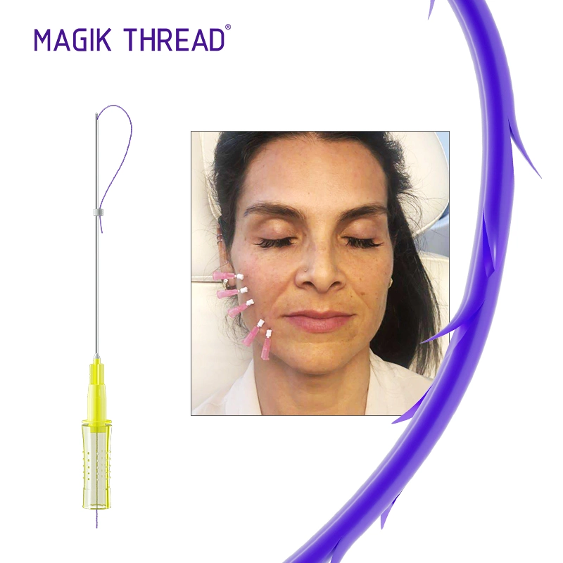 Magik Thread Medical Wrinkle Removal Fios Pdo Cog 4D Facial Lifting Pdo Thread