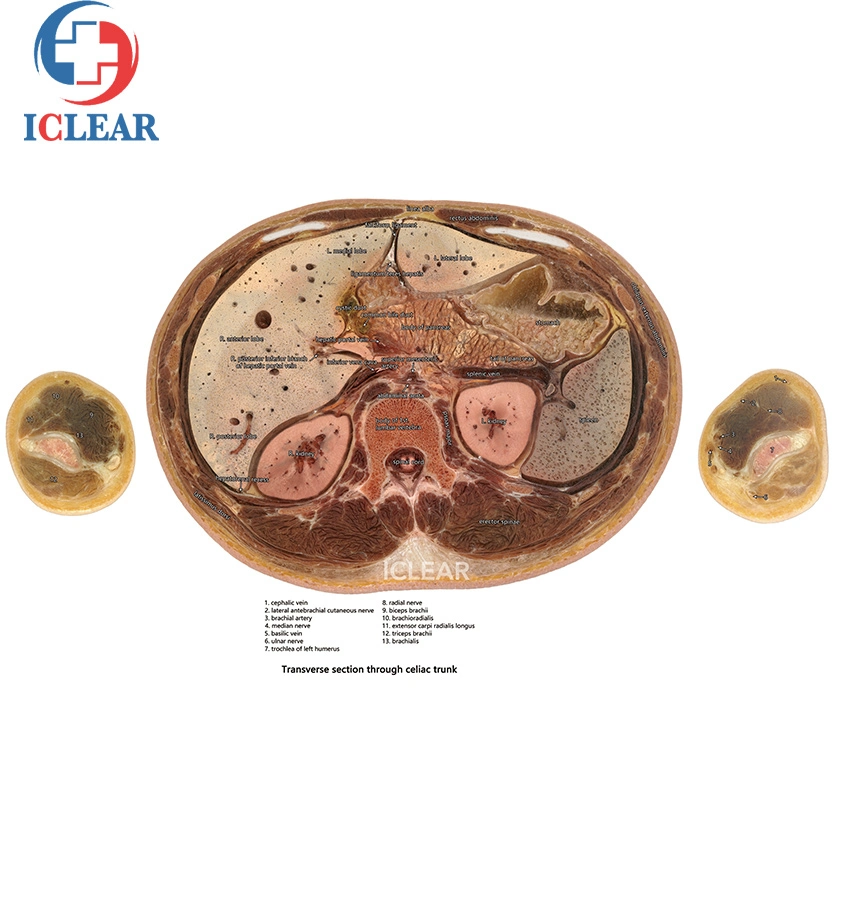 Medical Education Continuous Sectional Human Body Tomographic Visible 3D Printing Models