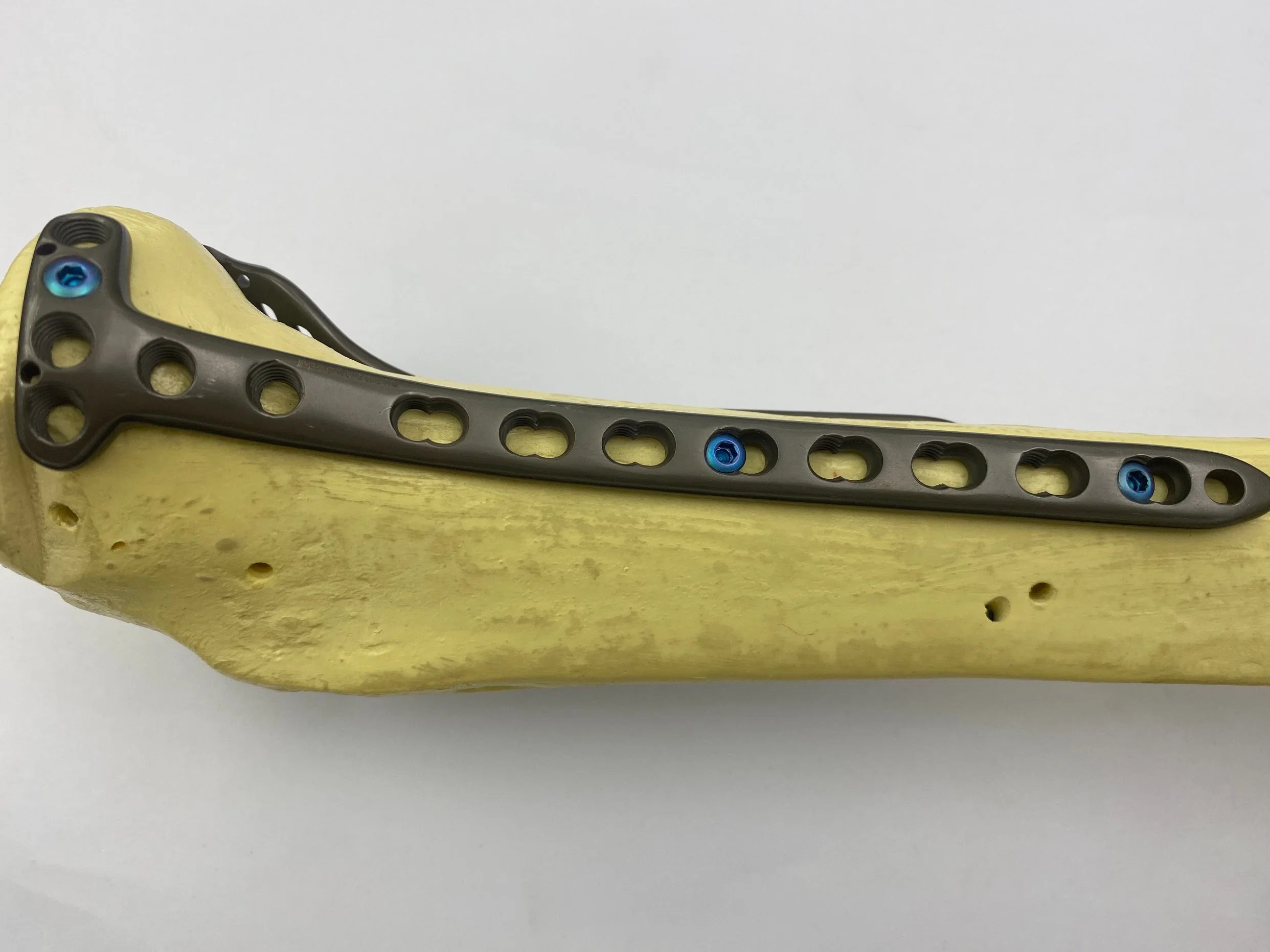 High quality/High cost performance  Orthopedic Lower Limb Implants Titanium Tibial Plateau Medial Locking Plate