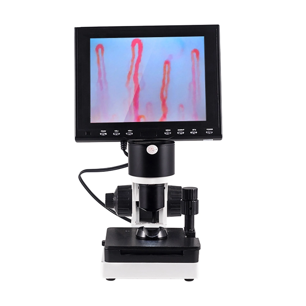 Microcirculation Microscope Health Analyzer Microcirculation Test Machine