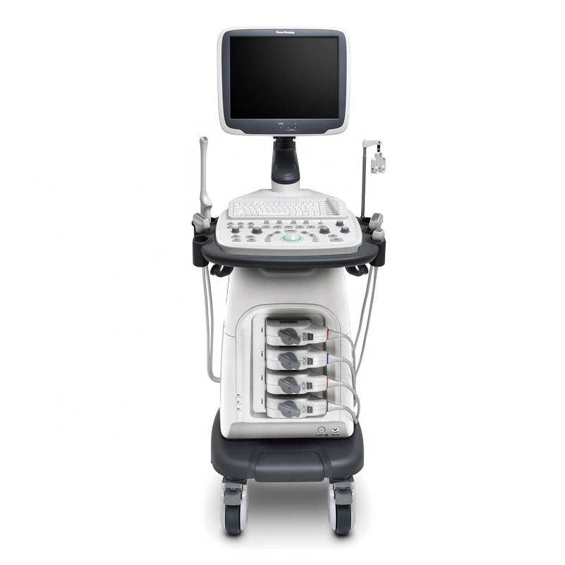 Sonoscape S11 Plus Mobile 3D/4D Color Doppler Ultrasound Scanner