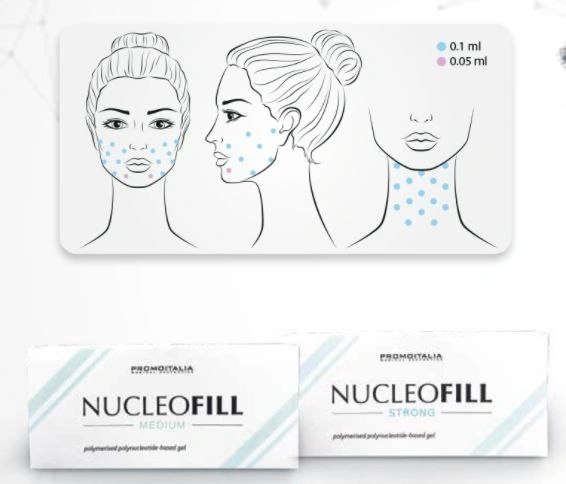 Kaufen Nucleofill oder Profhilo Strong Medium 1,5ml Weiche Augen Haar Mesotherapie Lifting auf zellulärer Ebene Behandlung Haut Booster Straffende Anti Alterungsfalten Produkte