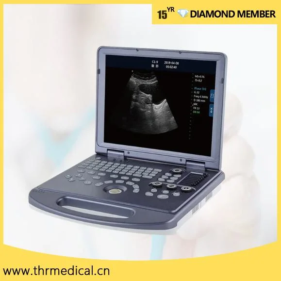 Medical B/W Portable Ultrasound Machine with Cheap Price (THR-USC60)