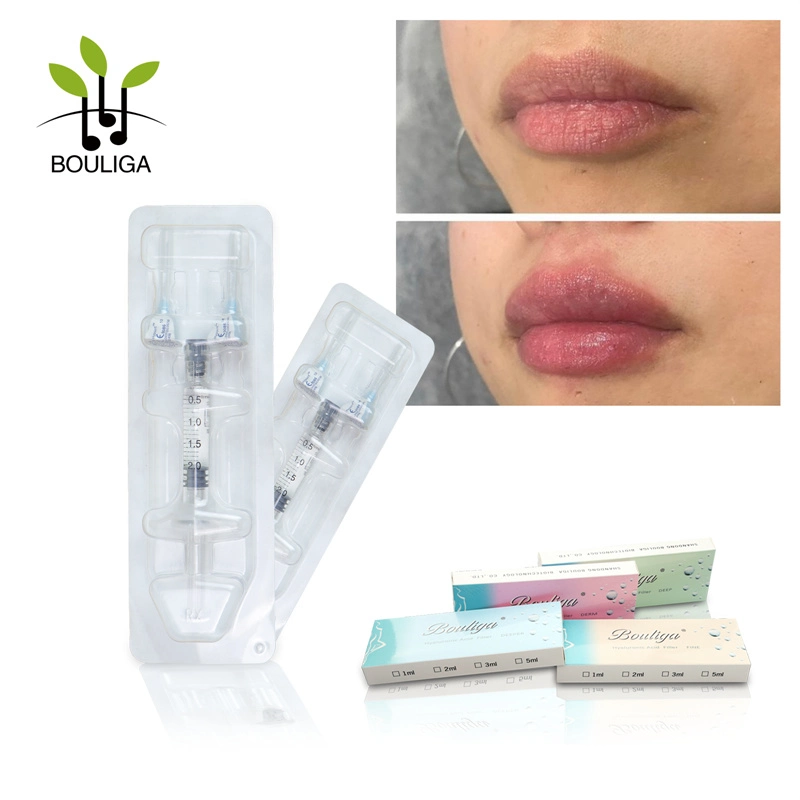 Bouliga 2ml Crosslinked relleno dérmico para labios mejorar