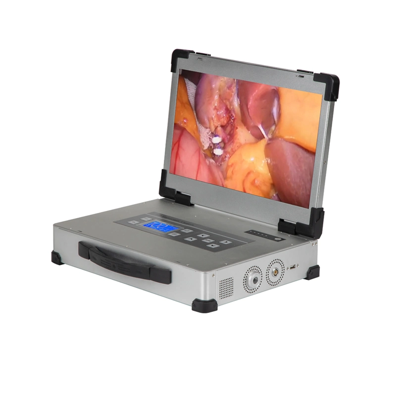 Equipamento de endoscopia Hospital médico HD 1080