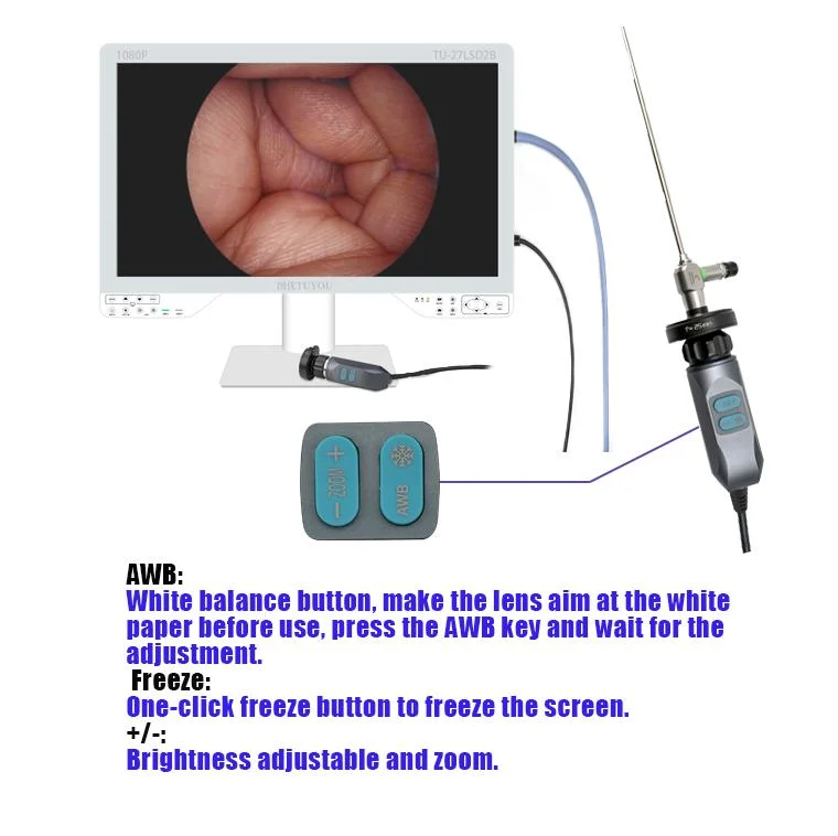 Equipamento de endoscopia Médica Tudvocê de valor elevado com endoscópio cirúrgico Câmara