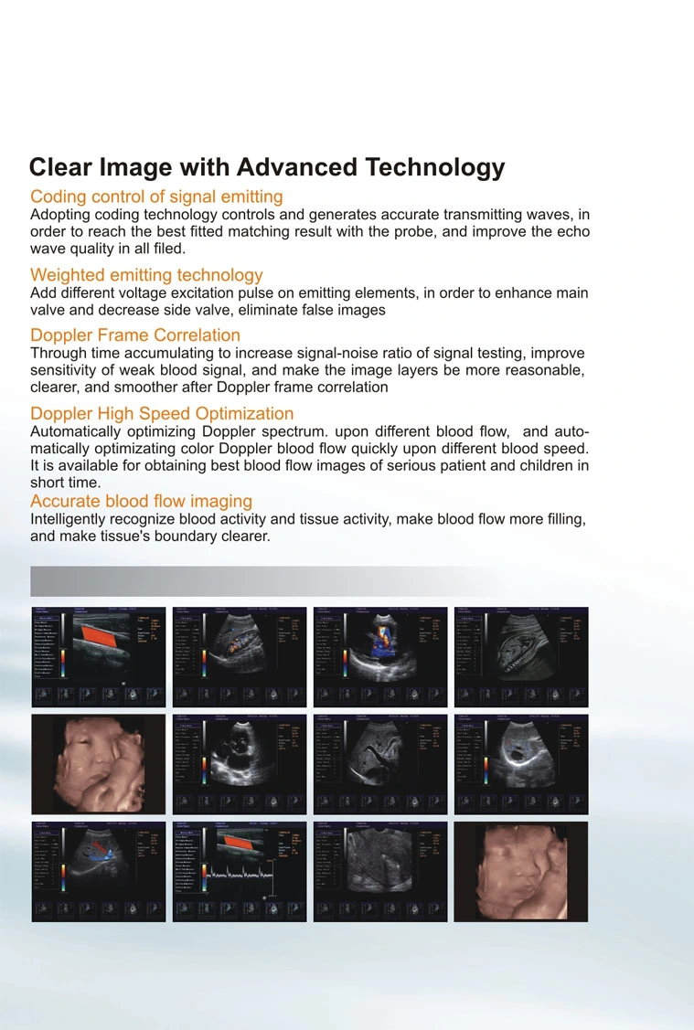 El diagnóstico médico 3D/4D del Sistema de ultrasonido Doppler Color