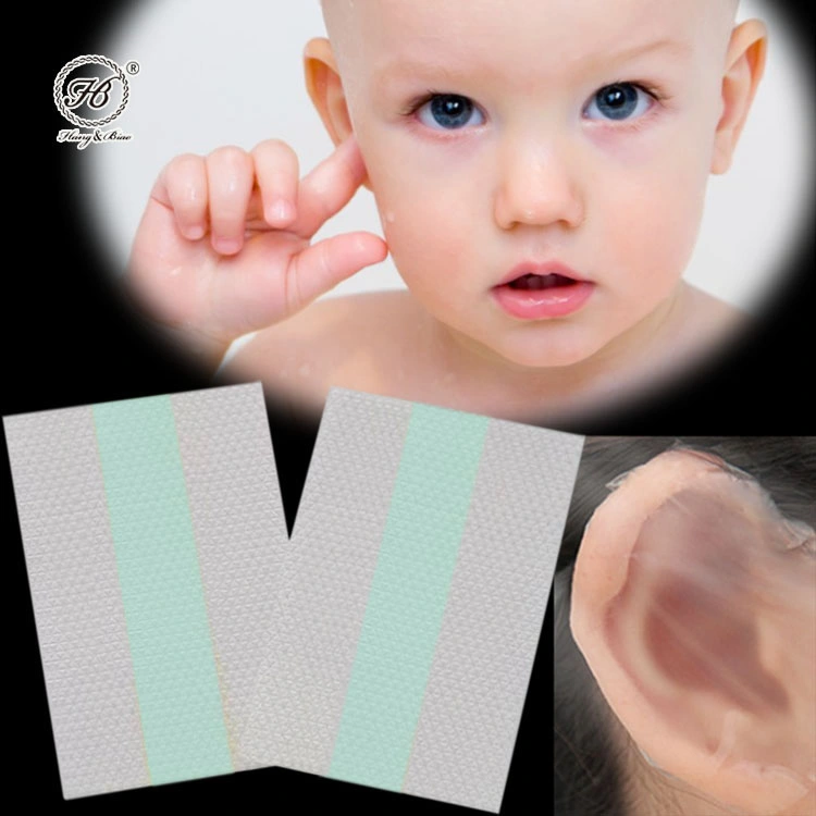 Protector de correção para bebé, autocolantes para protectores para ouvidos de recém-nascidos, fita para a orelha em silicone