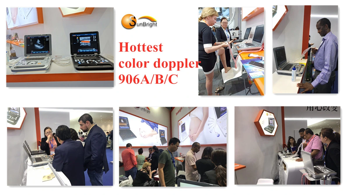 China Recently Best Medical Machine Ultrasound Equipment Price
