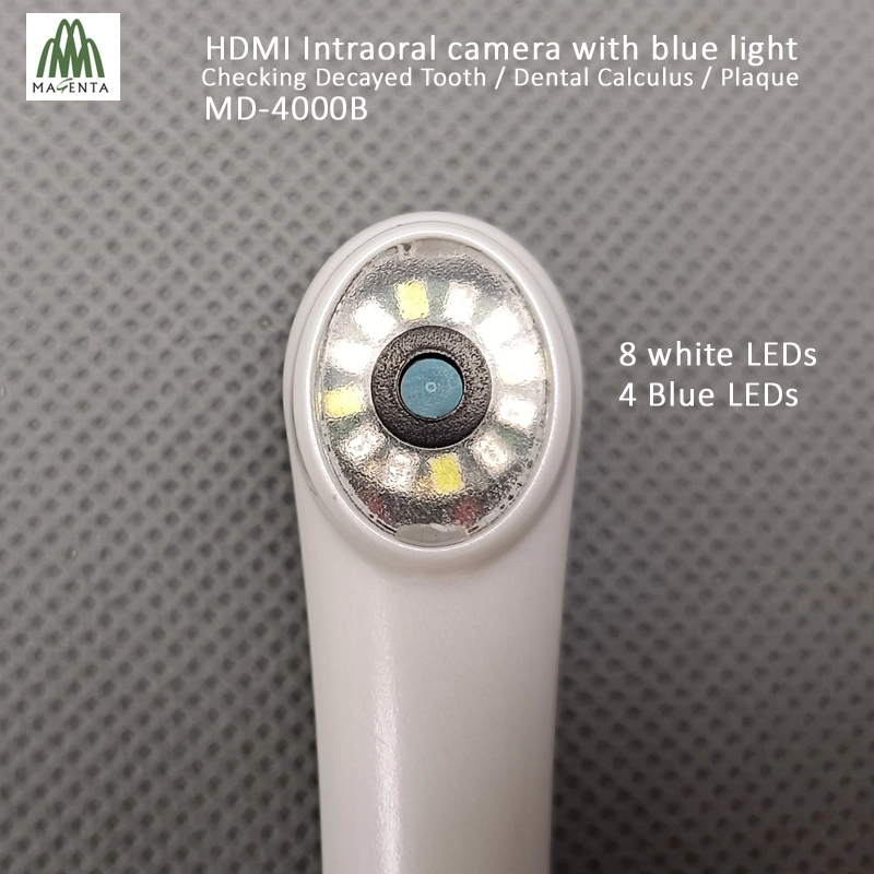 La luz azul y blanco de la Cámara Intraoral Dental de alta definición con HDMI y VGA Salida para la gran pantalla de televisión