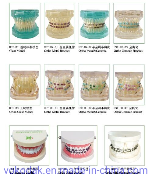 Dental Orthodontic Model with Ortho Ceramic Bracket