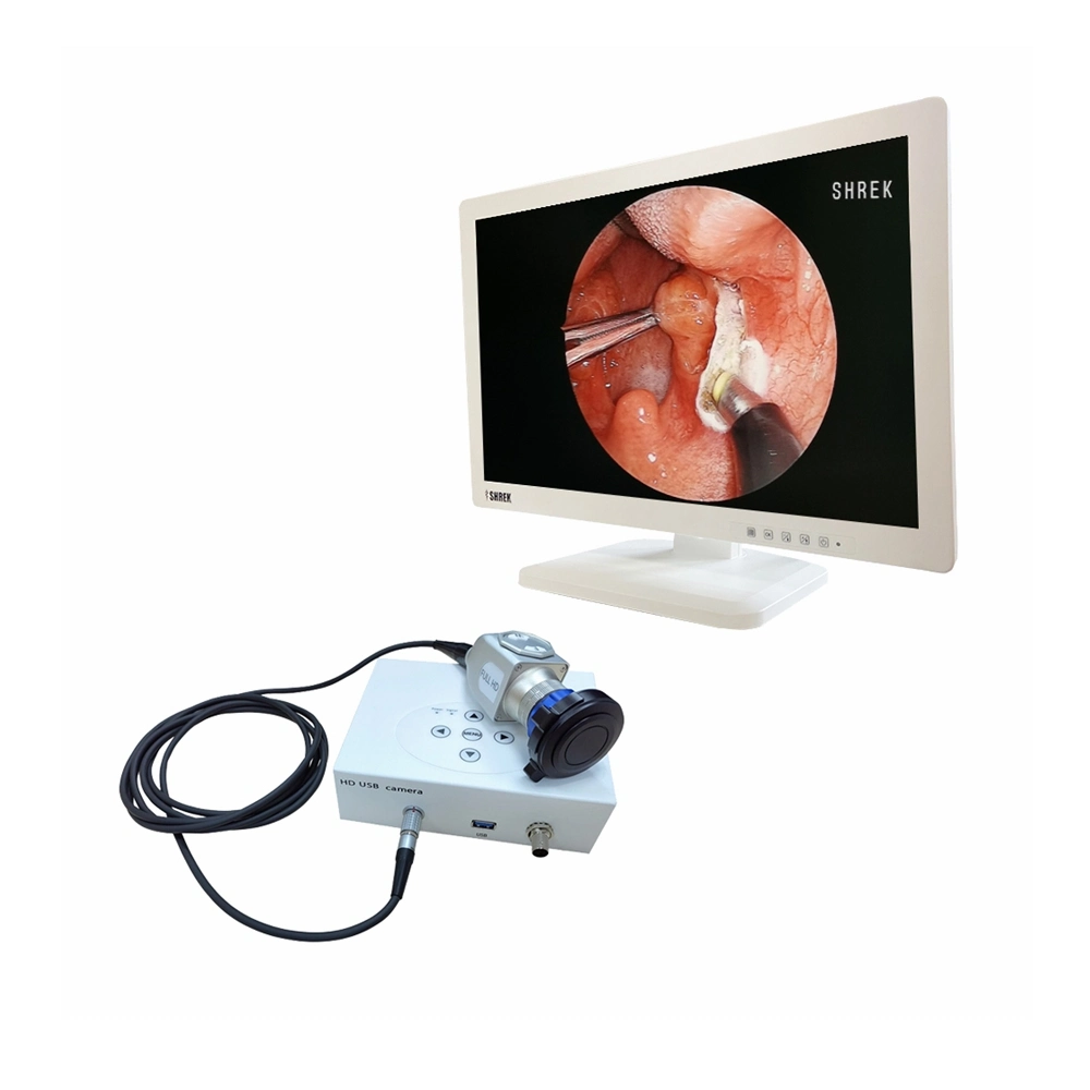 La Cámara USB portátil endoscopio para Otorrinolaringología Urología Athroscope endoscopia rígida