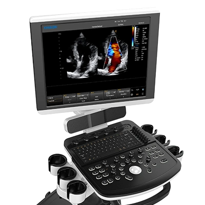 Chison Qbit 7 Trolley Color Doppler Ultrasound System