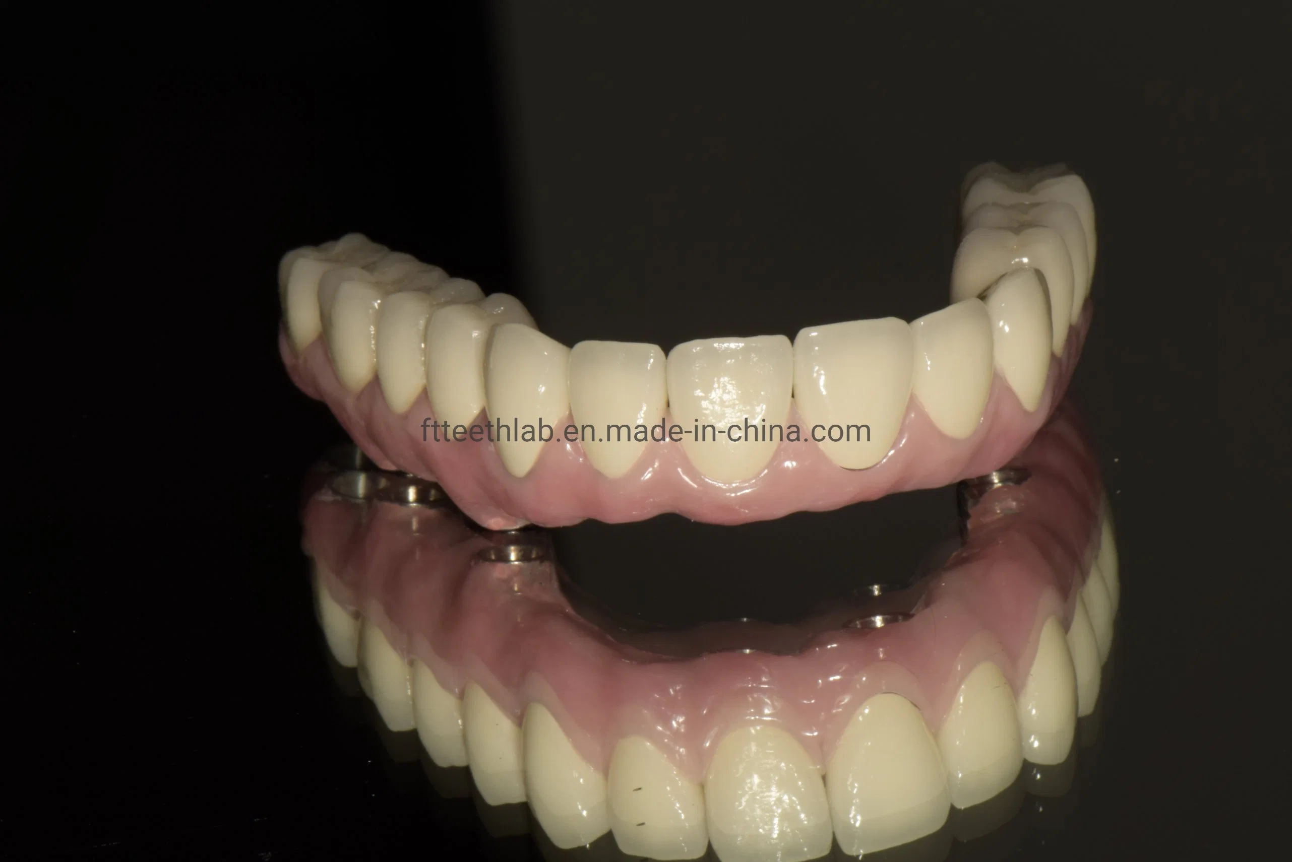 Full Arch Zirconia Screwed Implant Bridge