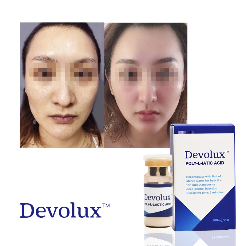 Devolux Reborn Plla Powder بولي حمض اللاكتيك Plla Powder لمدة الحقن