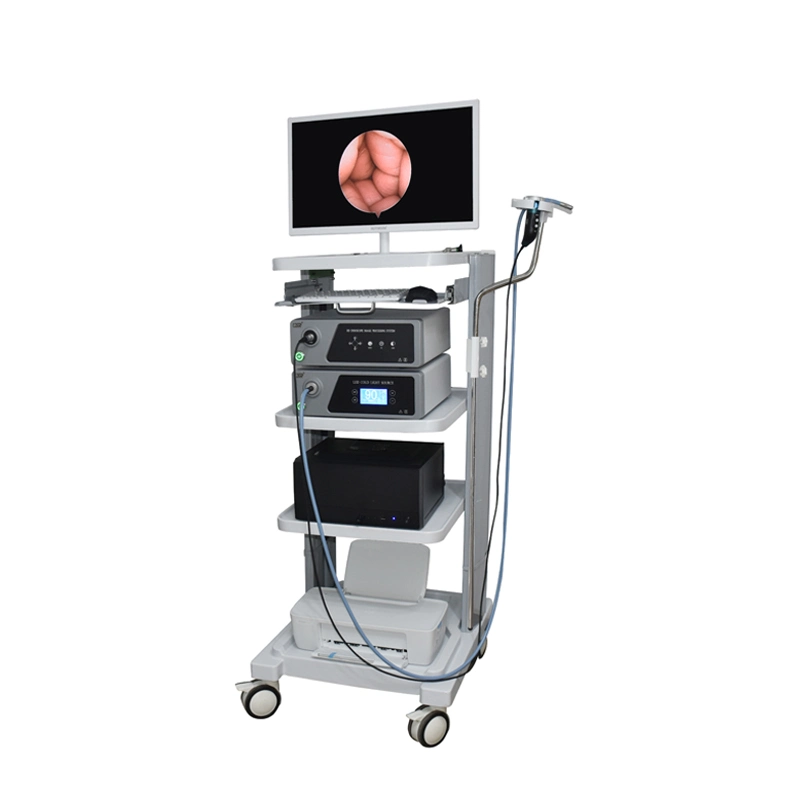 Medical Laparoscopy Tower Endoscopy System
