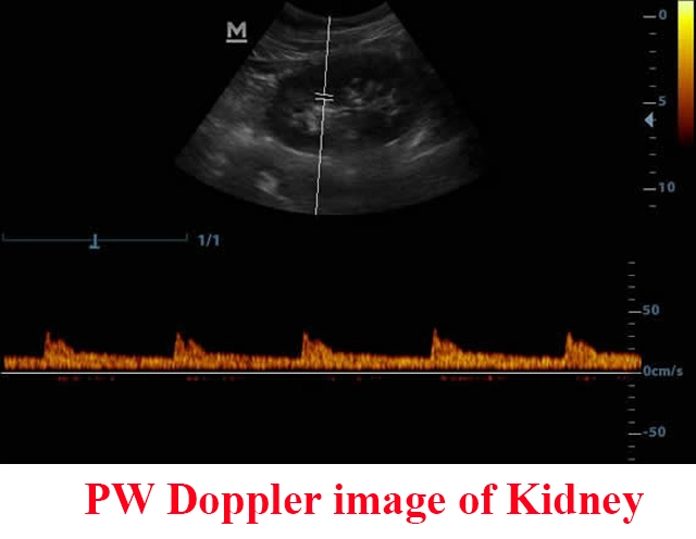 جهاز الموجات فوق الصوتية الرقمي المحمول Mindray DP-20 الأصلي مع Super Pw Doppler Image Mindray DP-20