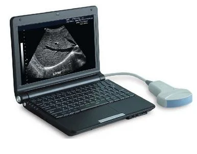 PT3000d1 Tragbares medizinisches Ultraschallsystem mit Punktionsfunktion, Diagnosegereichgerät