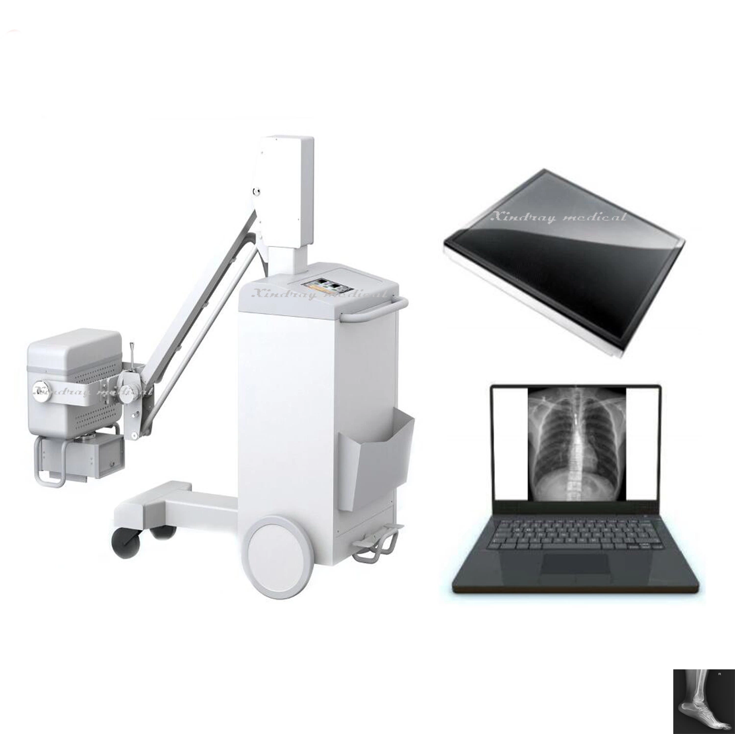 100mA X-ray Mobile Machine with Micro-Processing for Mobile Bed