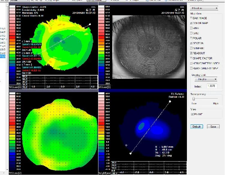 Topography Equipment Corneal Topographer