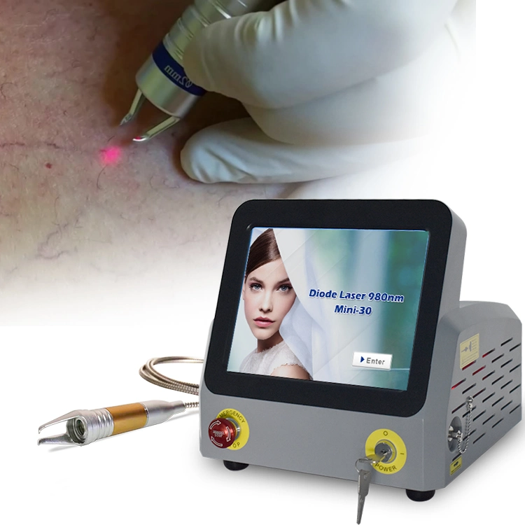 Медицинский лазер 60 Вт 980мм Spider Veins Vascular Machine Portable Non-Invasive Устройство для удаления сосудов Spider Vein