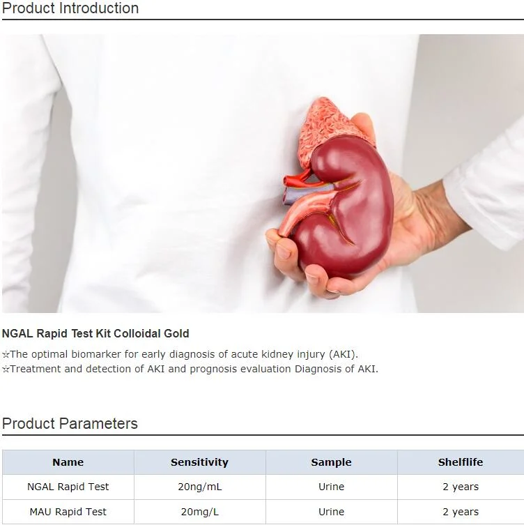 ODM OEM Neutrophil Gelatinase-Associated Lipocalin (NGAL) Elisa Kits for Kidney Injury