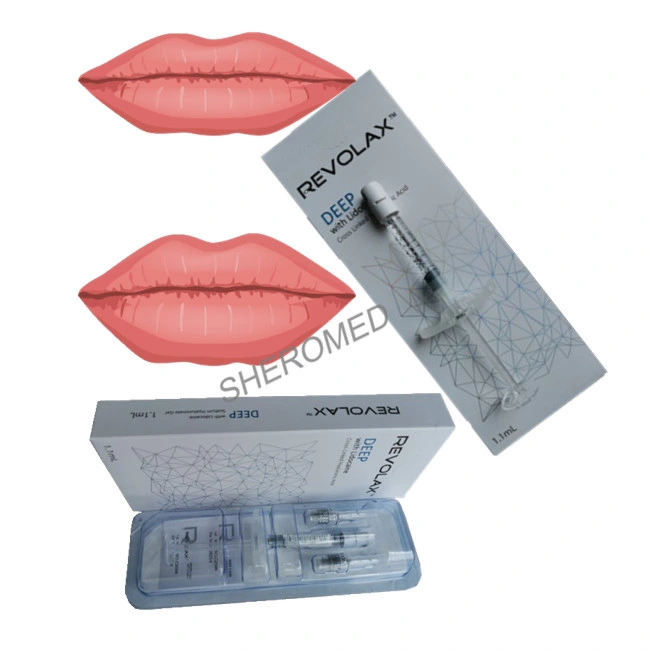 High quality/High cost performance  Sodium Hyaluronate Gel Revolax Deep Filler