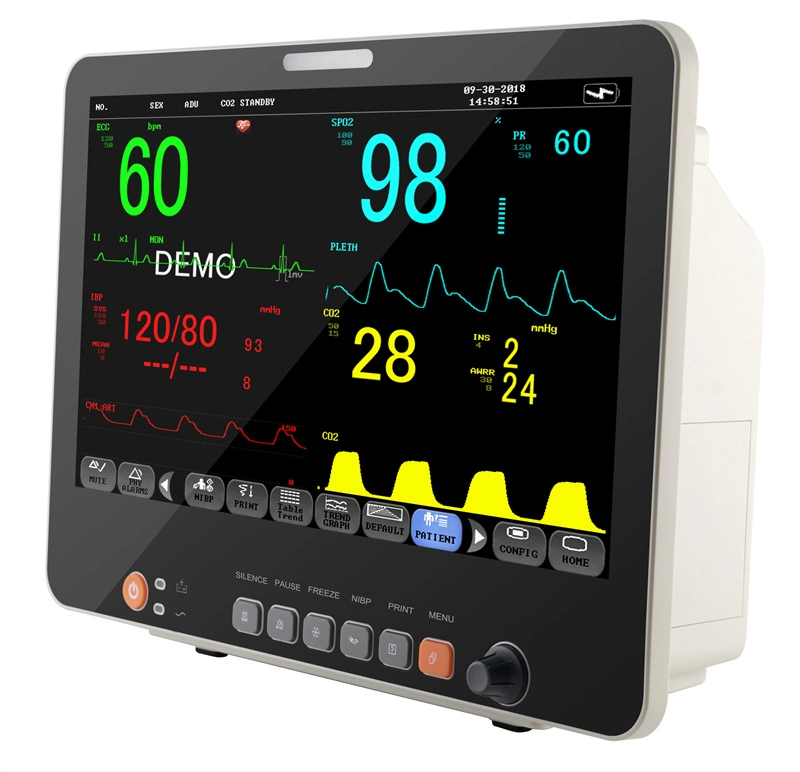 15.6 Inch with Printer Etco2 China Medical Surgical ICU Multiparameter Patient Monitor Price