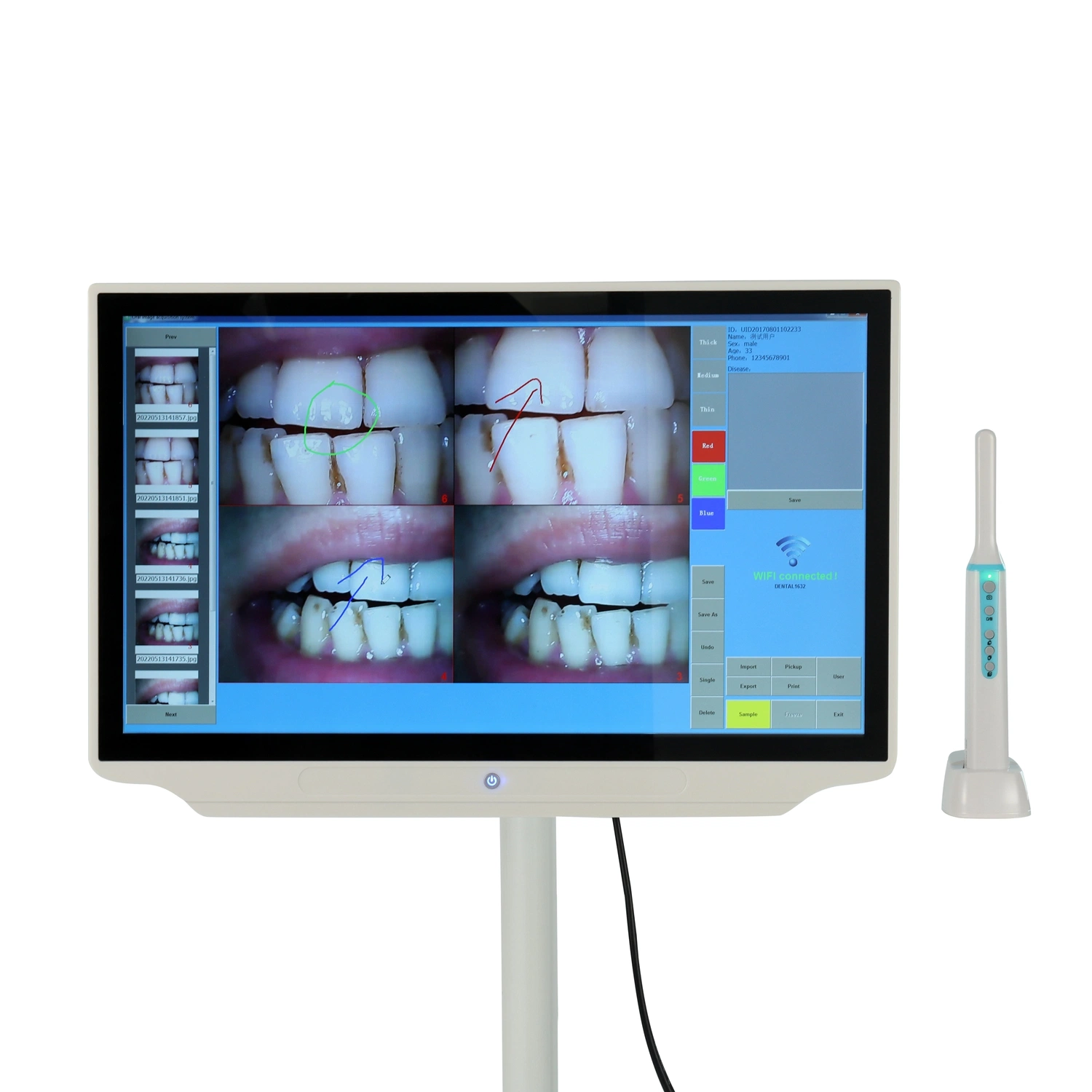 Equipo Dental de alta calidad El control remoto Cámara Intraoral WiFi con monitor LCD de 21,5"