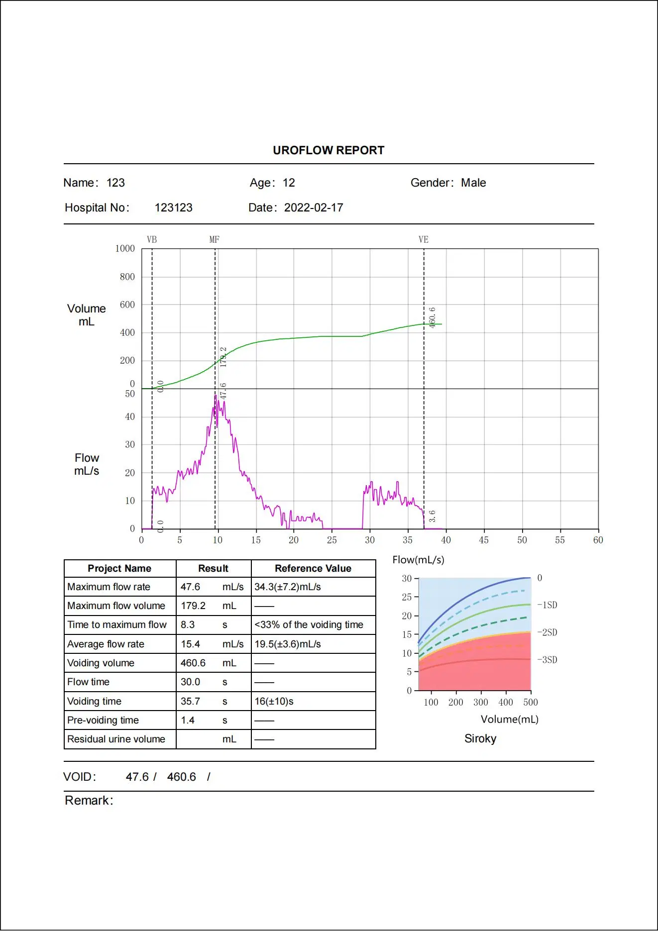 Medical Equipment ODM Simple PC Series1100ml Average Flow Rate Uroflowmetry for Urine Flowmeter