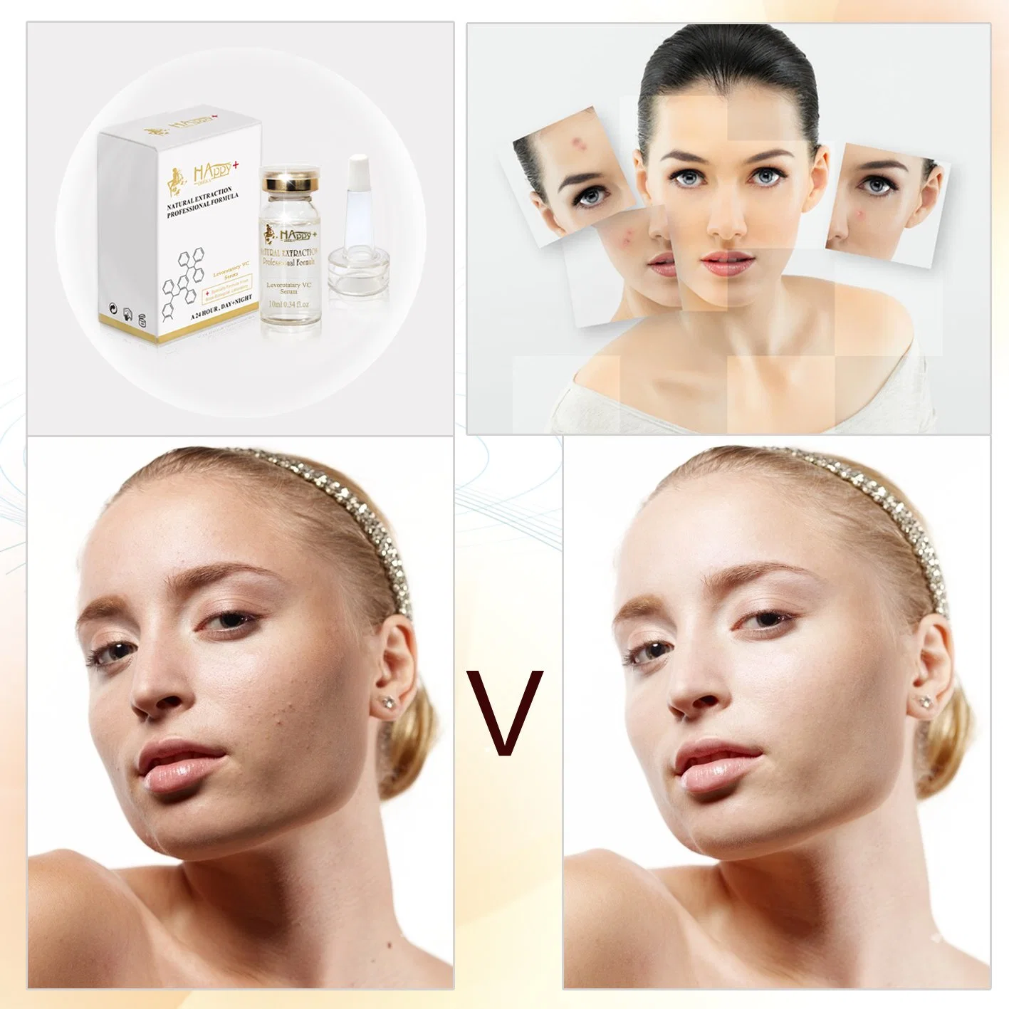 Whitening Anti-Ace Happy+ Levorotatory Vc Serum Hautpflege Serum