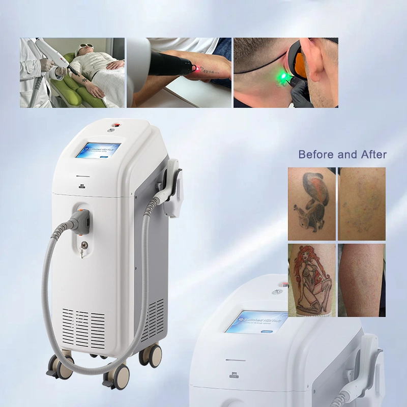 Aluminum Packed CE Certified Age Spot Removal Q-Switched Oat Tattoo Laser Machine