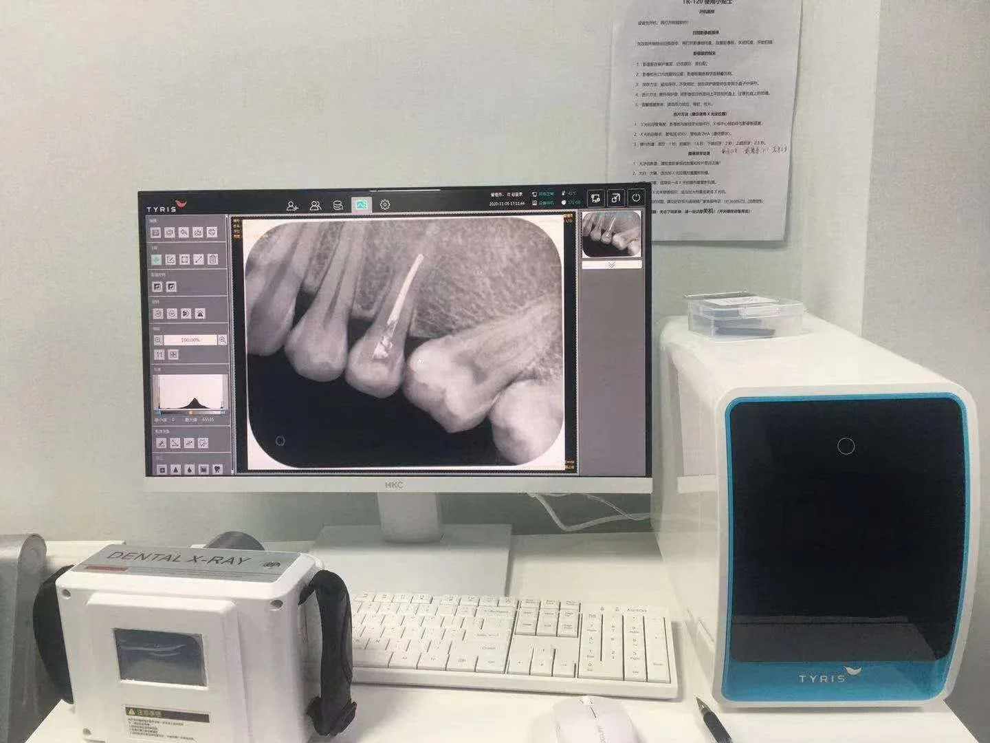 Korea Japan Good Price Touch Screen Portable Handheld Dental X-ray Film Camera Machine with USB Rvg Sensor