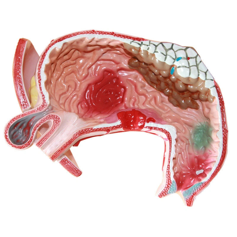 Tamaño de vida Modelo de estómago humano Modelo de estómago médico