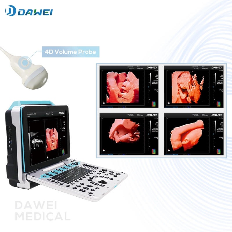 Hot Sales Ultrasound Scanner Equipment for Clinic with CE&ISO