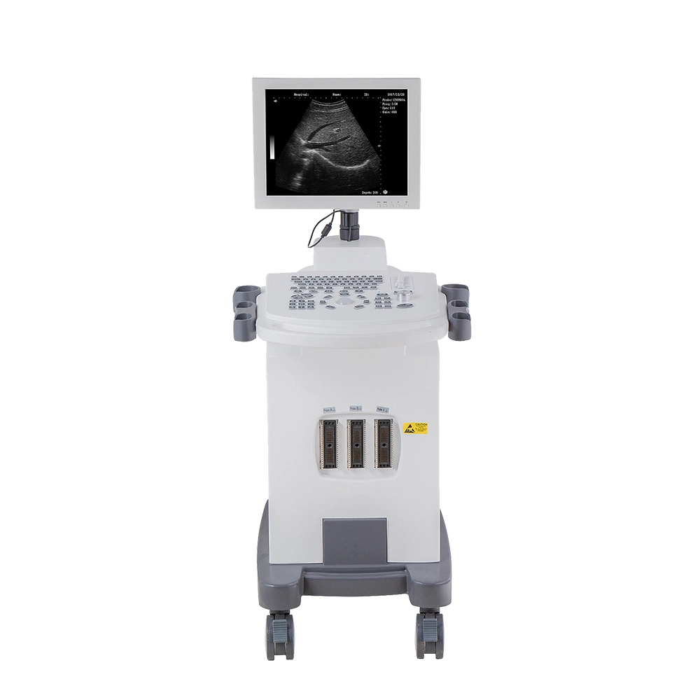 Ltub48V Middle-End PC Based Trolley Bw Veterinary Ultrasound Scanner for Pet Hospital