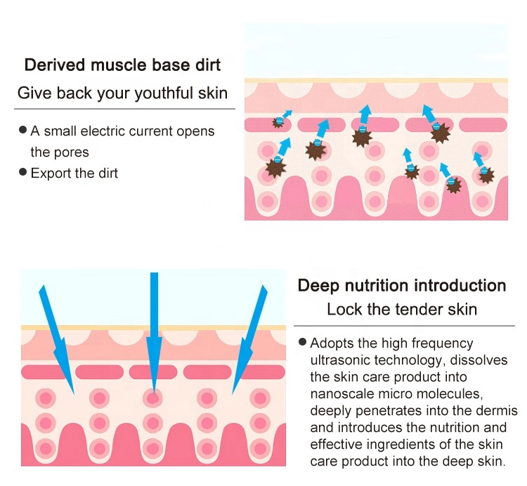 Limpeza facial ultra-sónica, bateria de iões negativa, portátil, multifuncional Rejuvenescimento da pele dispositivo de remoção de sardas de acne enrugado