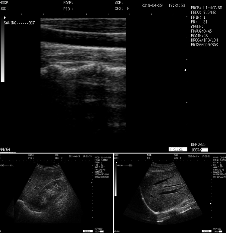 Computadora portátil de alta calidad Mecanmed 4D aparato de escáner equipos hospitalarios Ultrasound Con carrito