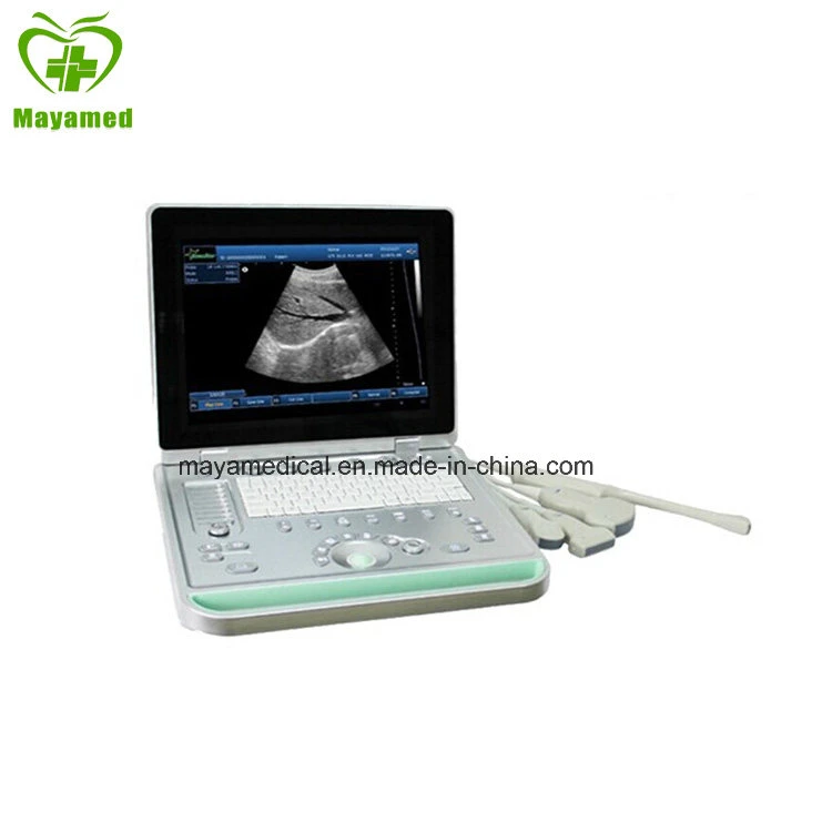 My-A009 15inch Screen PC Based Laptop Ultrasound B Scanner