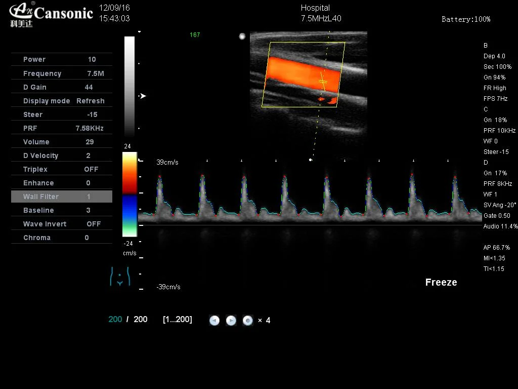 Trolley Color Doppler K10 Similar with Mindray