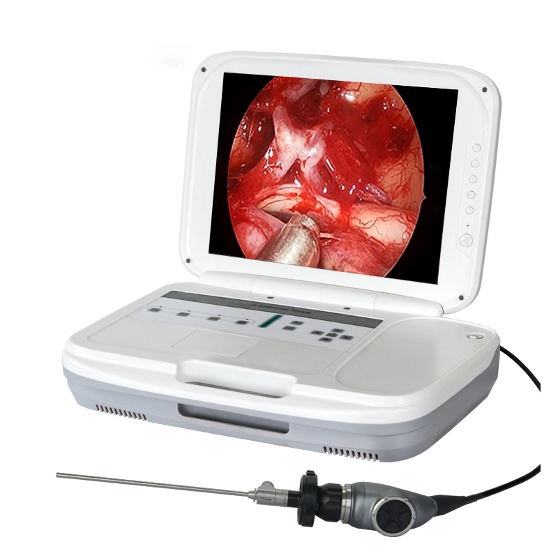 Manufacture Ent 3 in 1 4K Camera Urology Endoscopy Medical Endoscope System