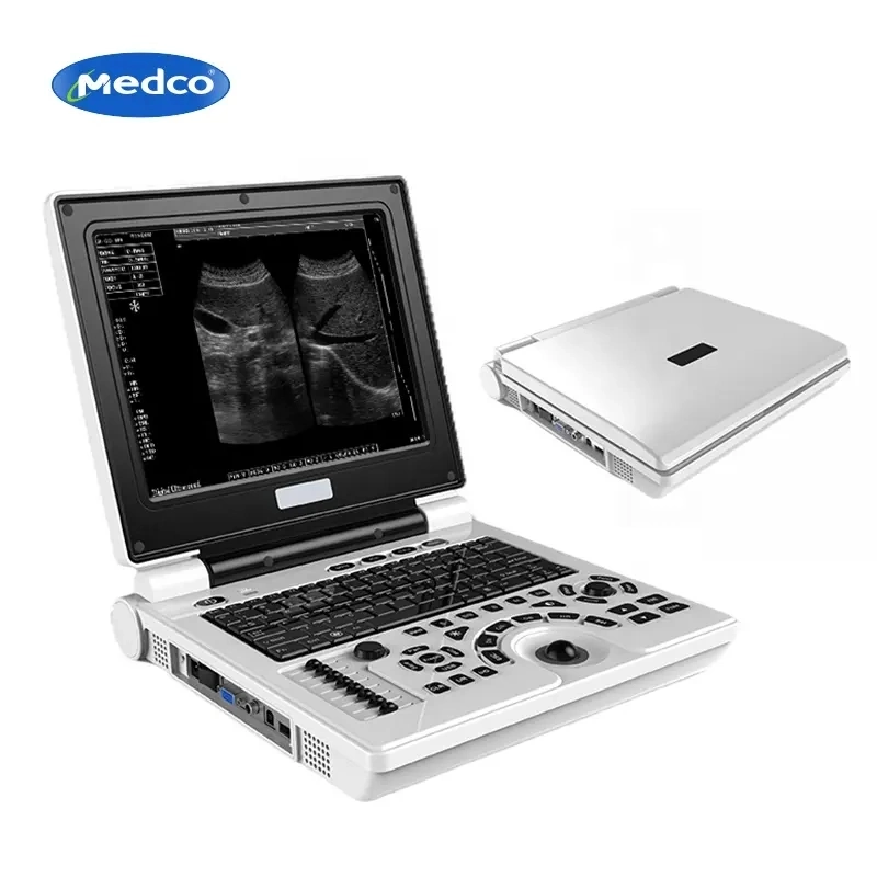 PU33A Ultrasound Portable Laptop Doppler Ultrasound Scanner