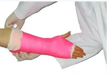 Colada de fundición de cinta de color rosa el vendaje para el brazo
