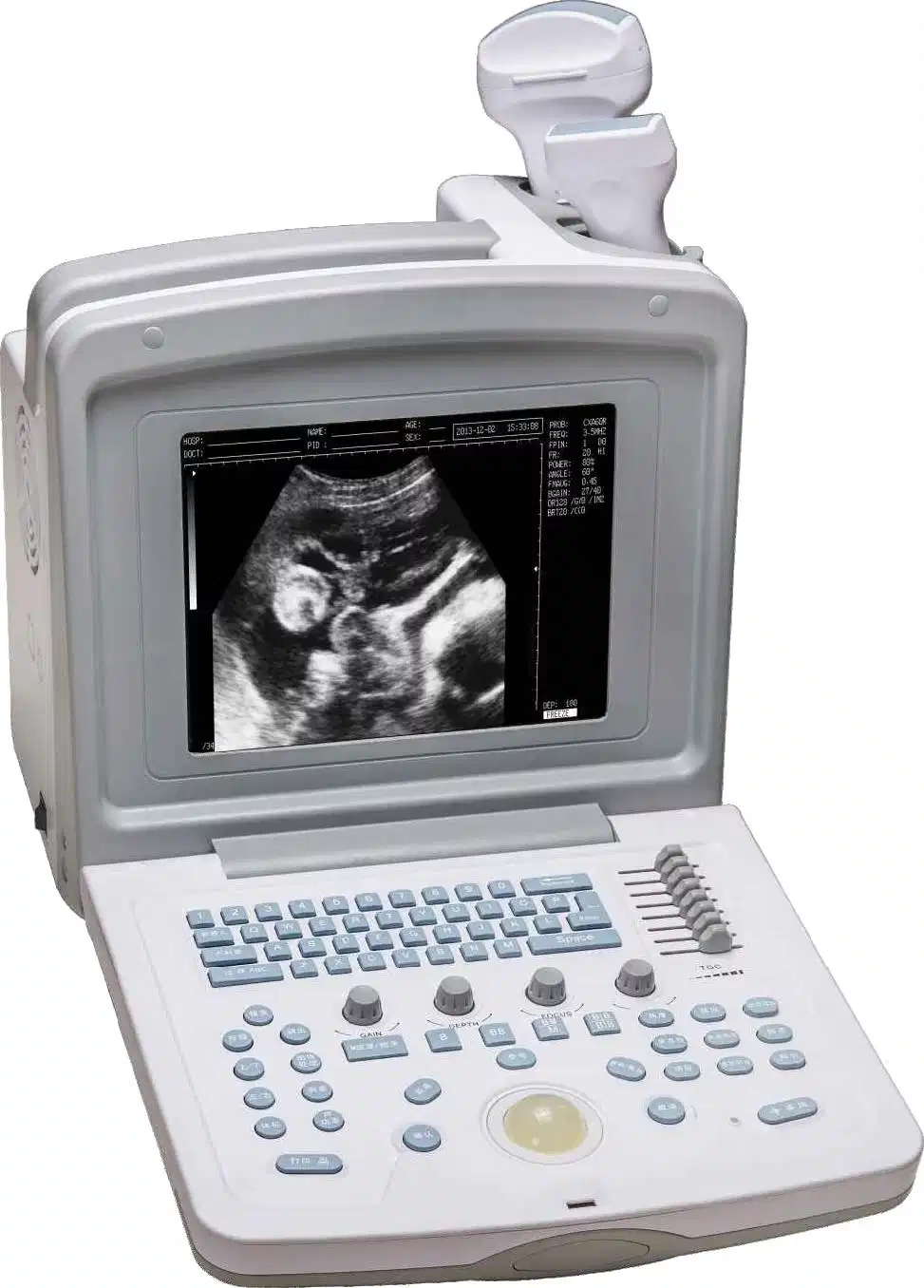 Full Digital Portable B/W Ultrasound Scanner for Veterinary Use