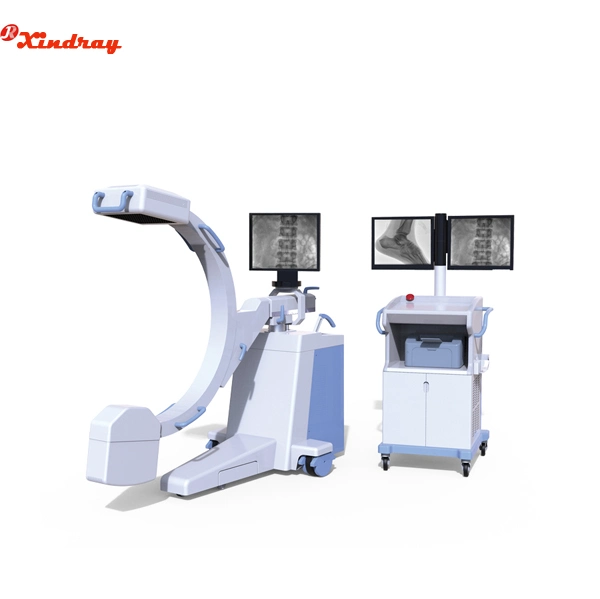 Manufacturer High Frequency Mobile Digital C-Arm X-ray Equipment