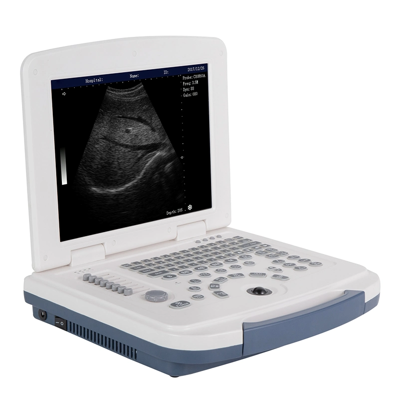 B/W Mecanmed Device Laptop Equipo médico portátil Ultrasonido con Buen precio