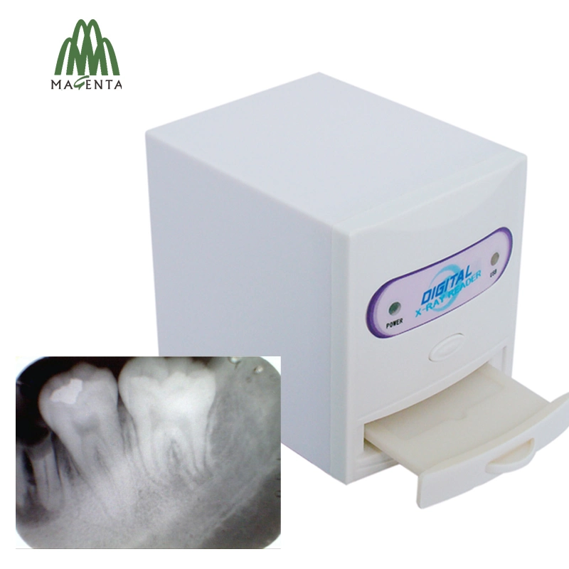 جهاز USB محمول لقارئ أفلام الأشعة السينية للأسنان/X Ray Viewer Dental Lab المعدة MD300