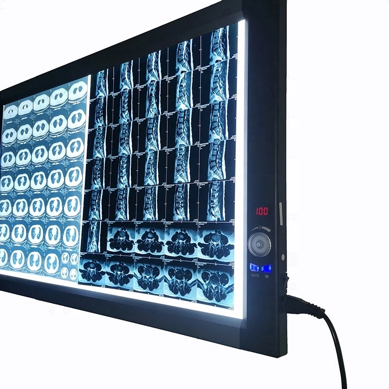 LED Medical XRay Film Viewer / XRay Film Illuminator Medical معدات الأشعة السينية والملحقات من الفئة I