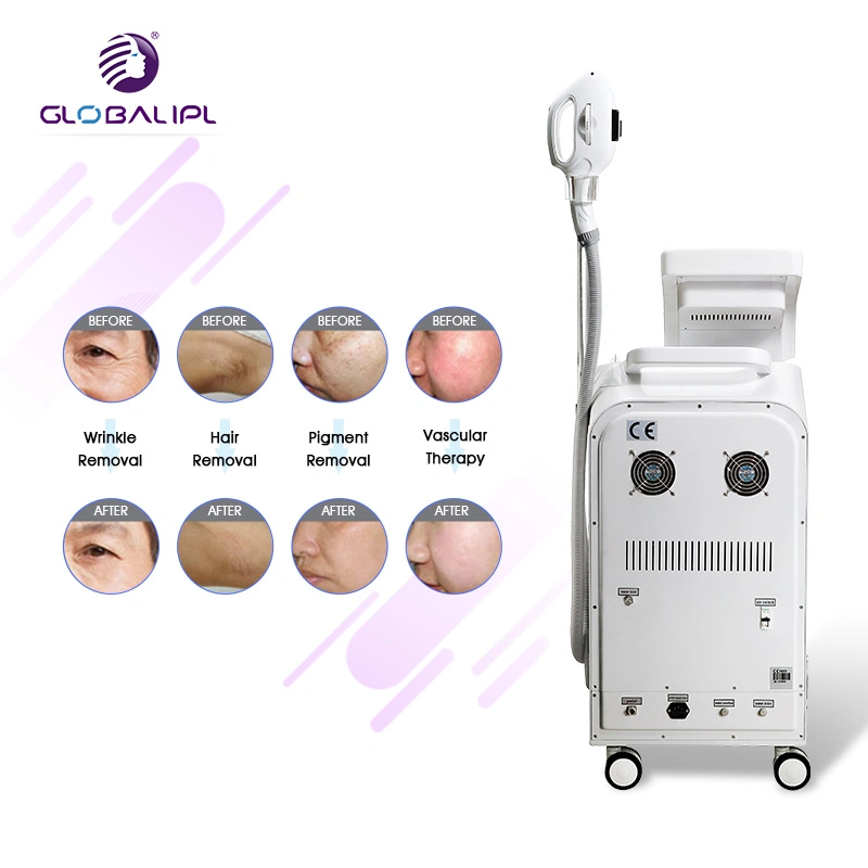 IPL Elight RF ND YAG Laser Machine Multifunctional Medical Beauty Equipments